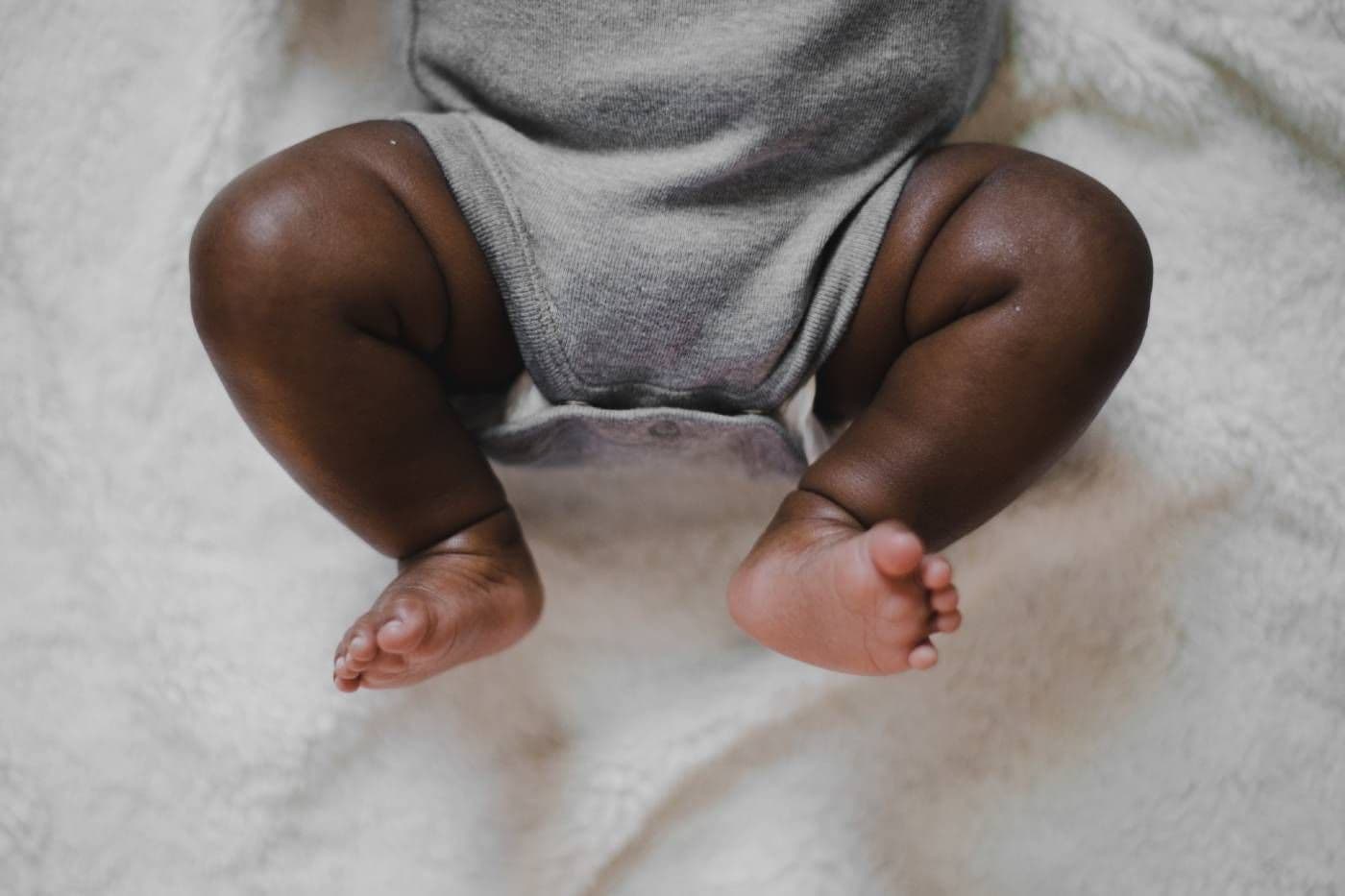 A baby's hips and legs