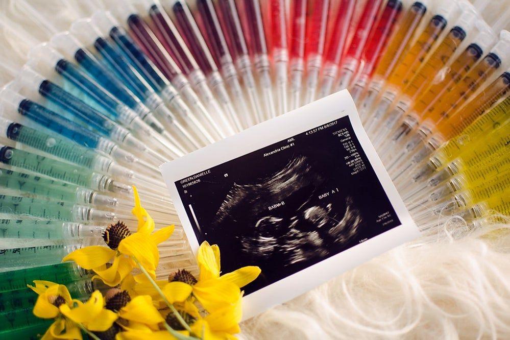 Needles arranged in a rainbow and displayed with ultrasound to announce an IVF pregnancy